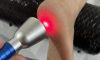 Local Specialists for High-Intensity Laser Therapy Available Now