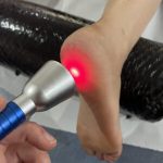 Local Specialists for High-Intensity Laser Therapy Available Now