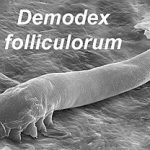 Demodex Mites’ Role in Chronic Dry Eye Explained