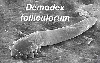 Demodex Mites’ Role in Chronic Dry Eye Explained